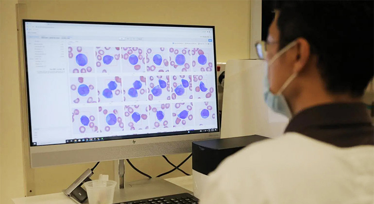 The AI analyses blood films and flags critical ones, such as cases of leukaemia. Image courtesy of SPH Media.